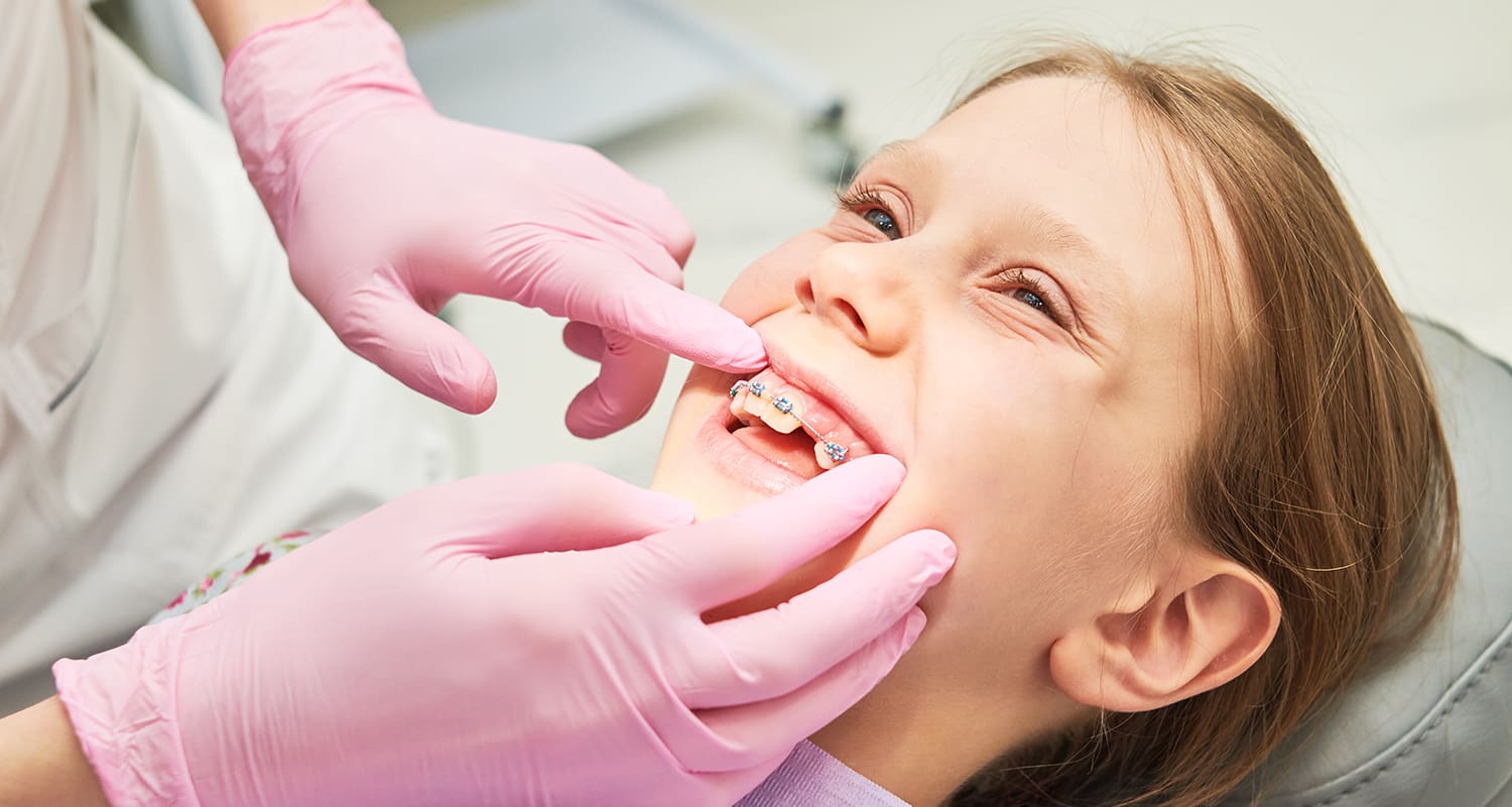 When Should Kids Get Braces? Here’s What Parents Need to Know