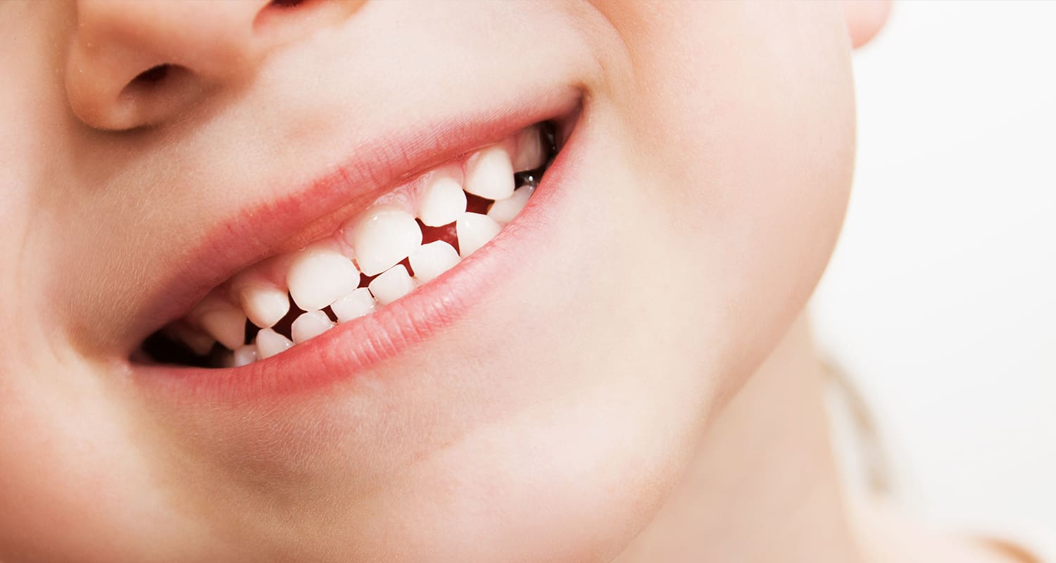 Expert Teeth Cleaning for Kids: Why Our Hygienists Make All the Difference