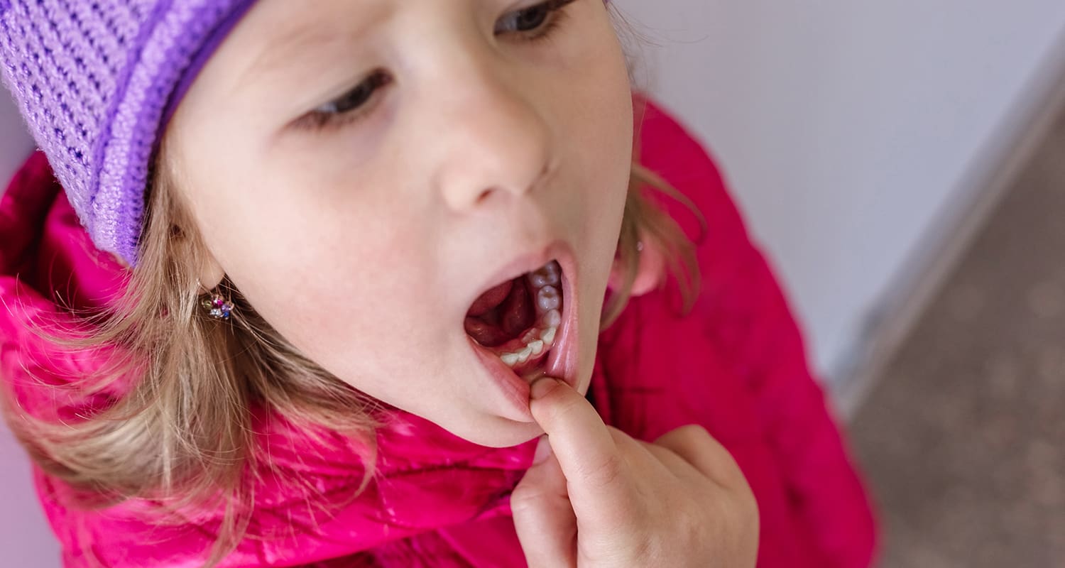 Is My Child Losing Baby Teeth Too Early? A Guide for Overland Park Parents