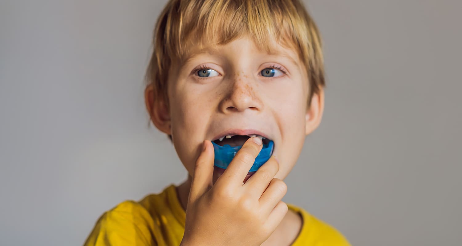 Mouthguards for Kids: Protecting Smiles During Sports & Sleep