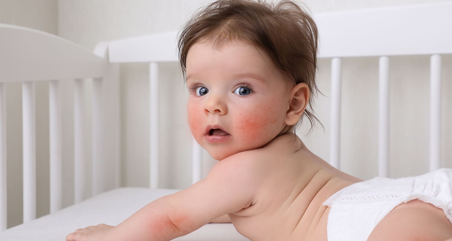 Red Cheeks in Babies: Is It Teething or Something Else?