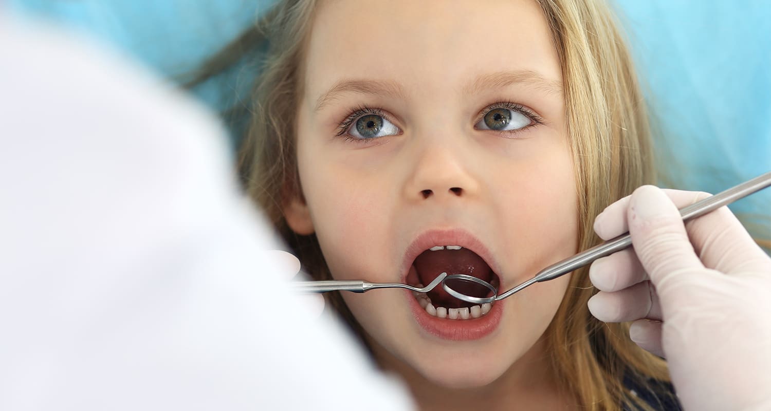 Hypodontia: When Permanent Teeth Do Not Develop