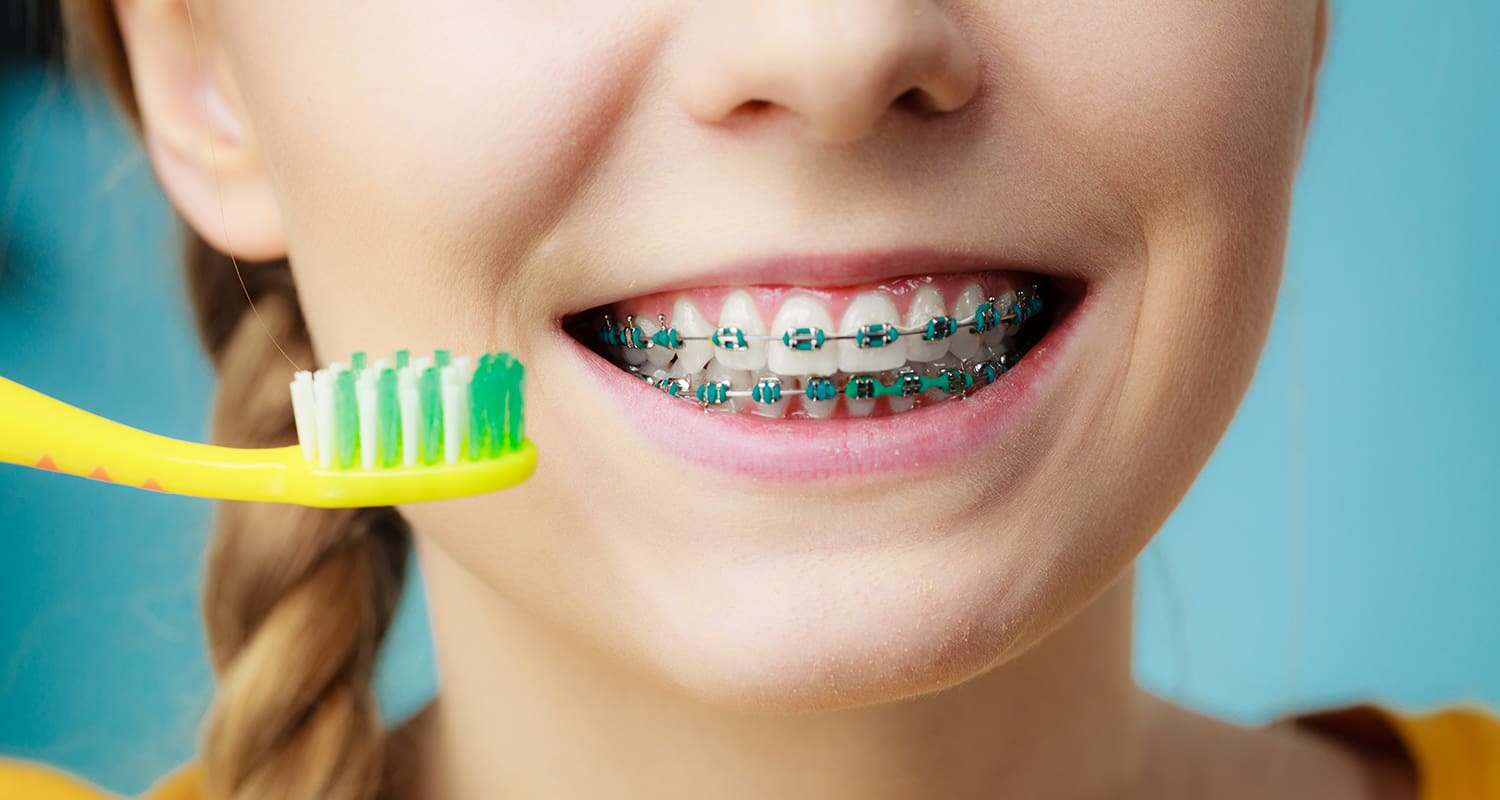 Brushing With Braces Made Simple
