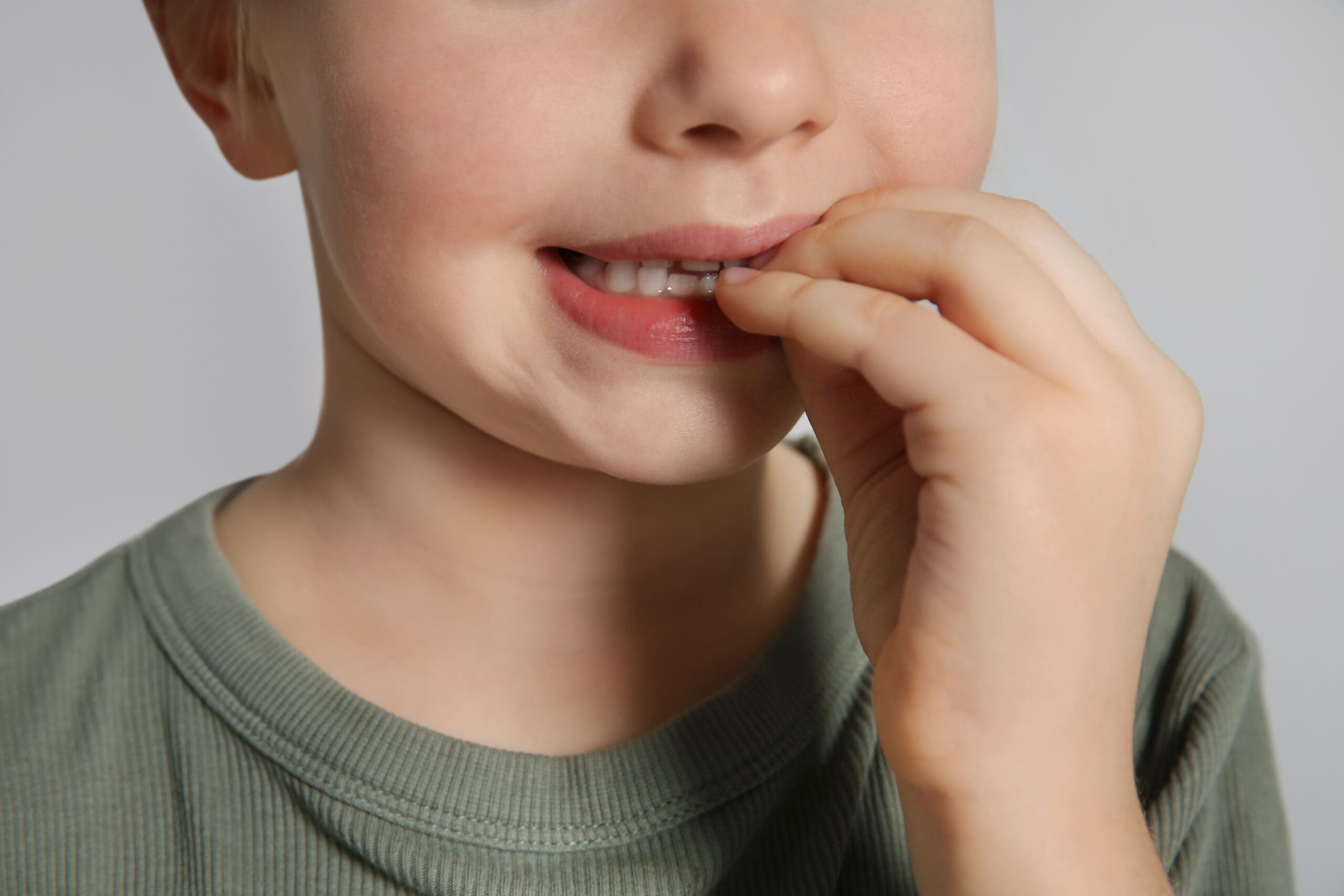 How Nail Biting Can Affect Your Child's Teeth and Oral Health